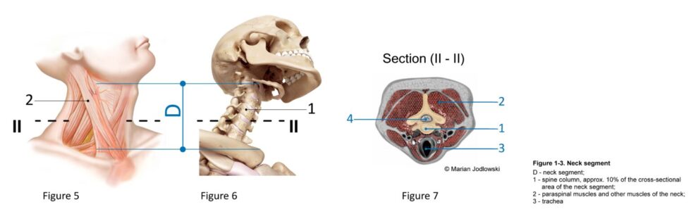 Figure 5 7 1536x476 1 980x304 1 6. Is Stuart McGill method for human body mechanics correct?