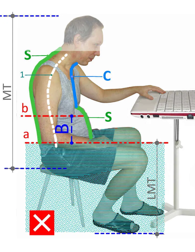 Bent sitting position - a slim person with stretched abdominal muscles